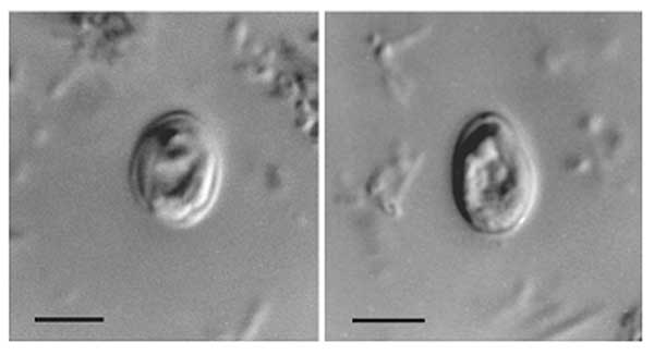 Water Treatment 101: Cryptosporidium